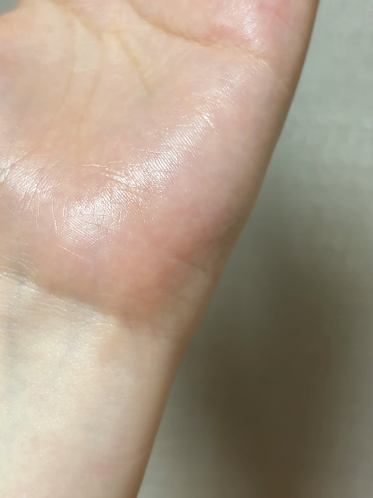 잇츠스킨 (IT'SSKIN) 닥터세이버스 세럼 [시카컴포트] review image