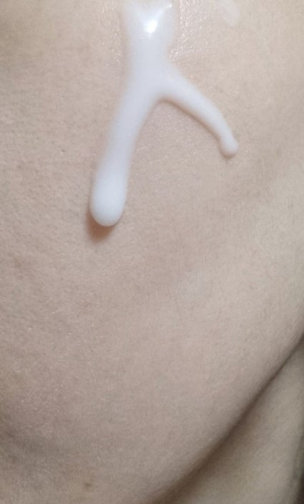 Ảnh đánh giá thực tế của người dùng về Kem trị mụn North Canine