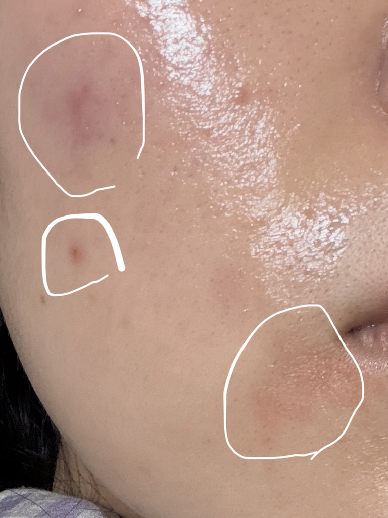 에스트라 (AESTURA) 에이시카365 흔적진정세럼 pH4.5 review image