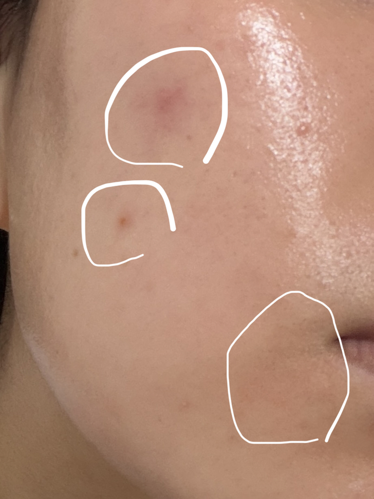 에스트라 (AESTURA) 에이시카365 흔적진정세럼 pH4.5 review image