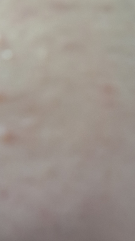 Ảnh đánh giá thực tế của người dùng về Trị mụn và cân bằng da 131 ống