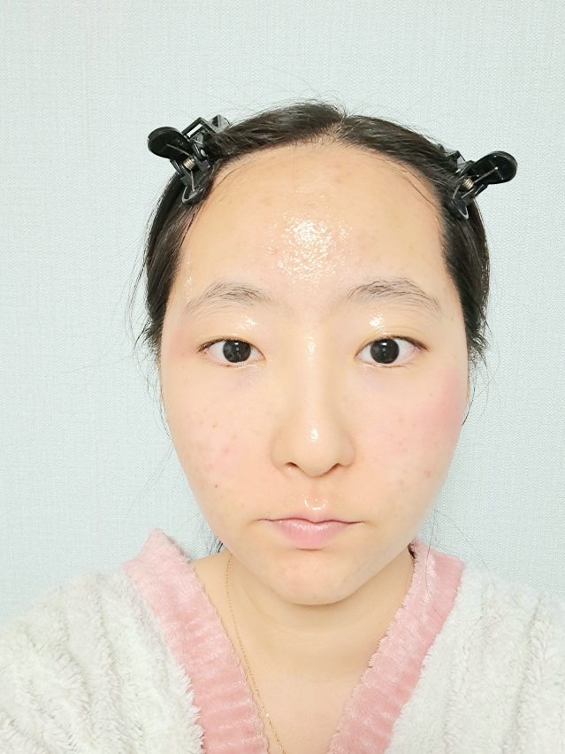 이옴 (EIoM) 트러블 타겟팅 세럼 review image