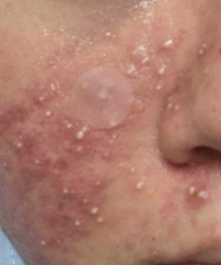 Ảnh đánh giá thực tế của người dùng về ZincTeca Trouble Serum