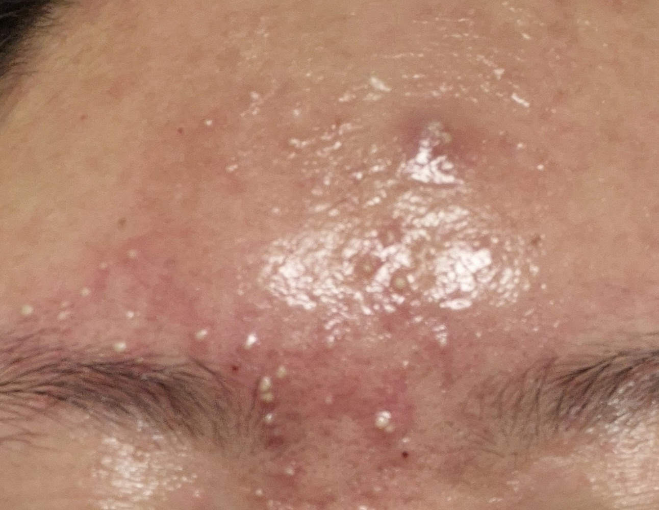 Ảnh đánh giá thực tế của người dùng về ZincTeca Trouble Serum