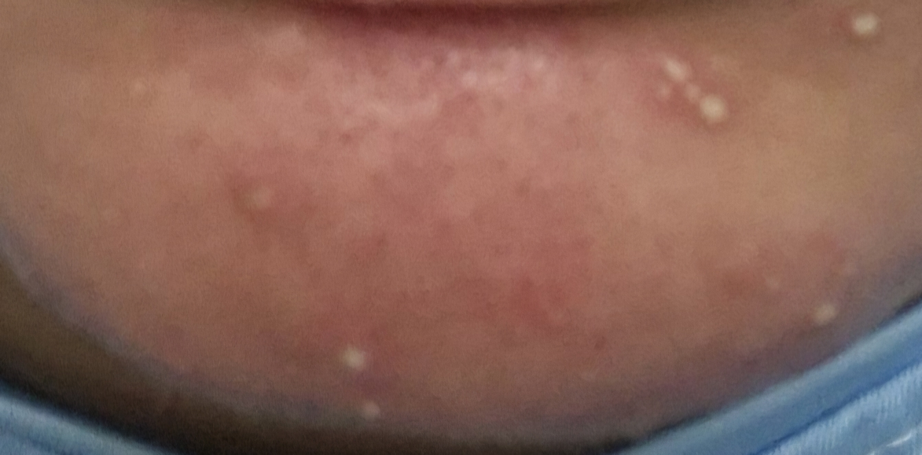 Ảnh đánh giá thực tế của người dùng về ZincTeca Trouble Serum