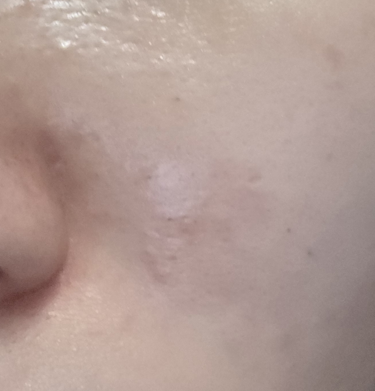 Ảnh đánh giá thực tế của người dùng về Toner Hyaluronic Acid siêu phân tử