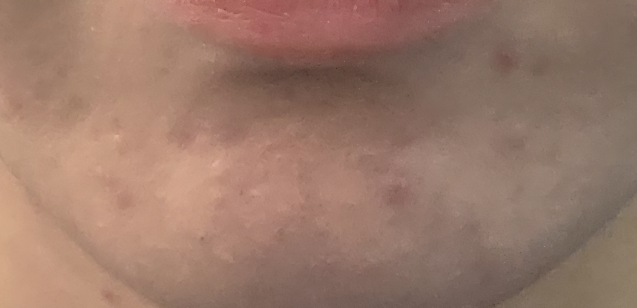 illumiel+ Miếng đệm hình vuông giữ ẩm review image