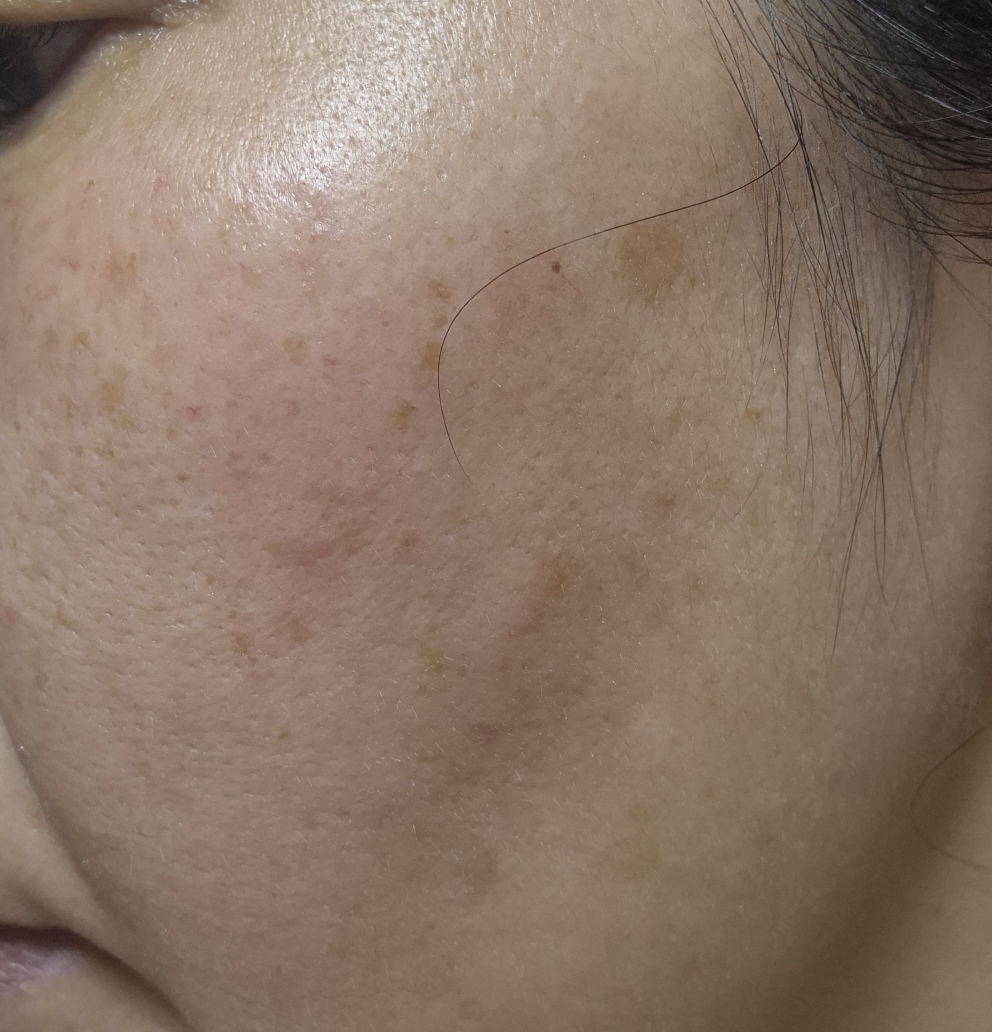 디오프러스 (DEOPROCE) 기미 클리어 크림 review image