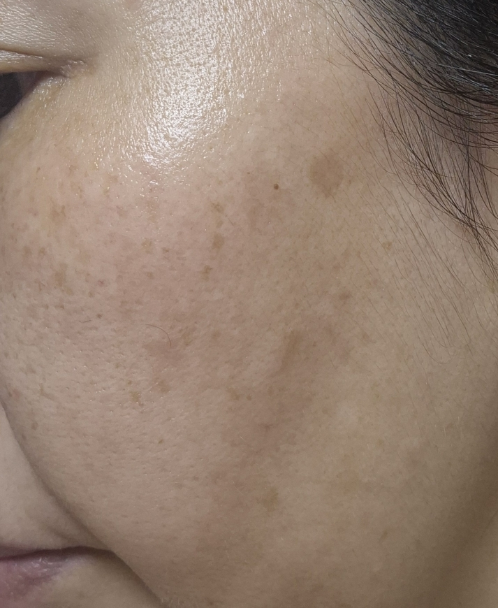 디오프러스 (DEOPROCE) 기미 클리어 크림 review image