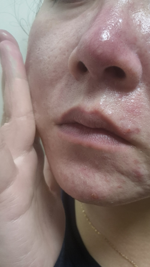 스킨앤랩 (SKIN&LAB) 베리어덤 링거 앰플 review image