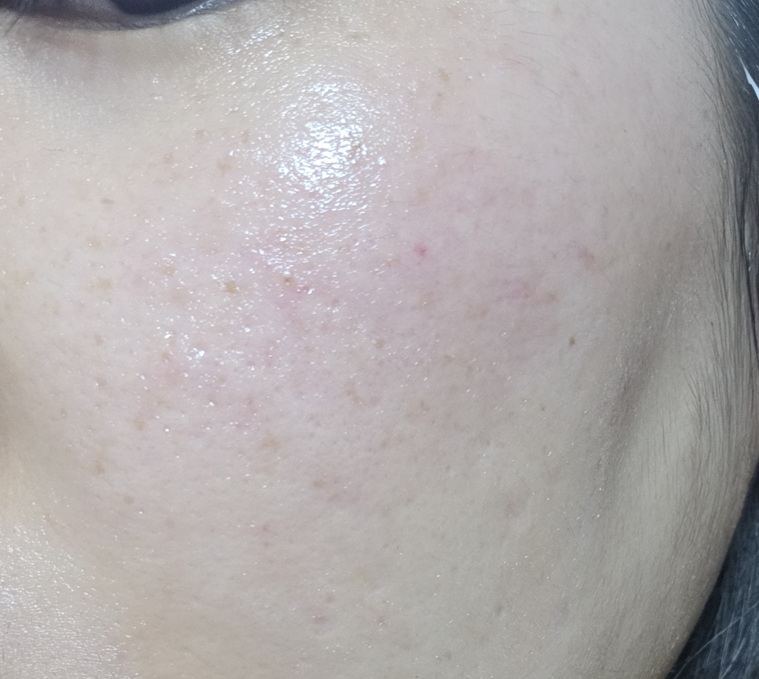 바이오더마 (BIODERMA) 시카비오 포마드 review image