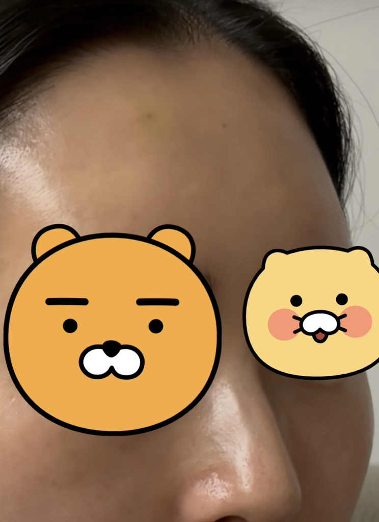 아로셀 (AROCELL) 슈퍼 콜라겐 마스크 review image