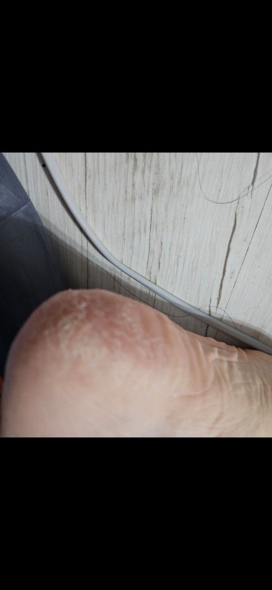 바세린 (Vaseline) (유니레버) 오리지널 프로텍팅 젤리 review image