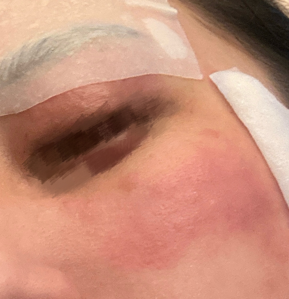 Ảnh đánh giá thực tế của người dùng về 1025 Lotion Dokdo