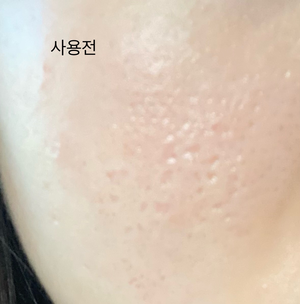 보나메두사 (bonamedusa) 오렌지 스킨 딜리트 [오리지널] review image