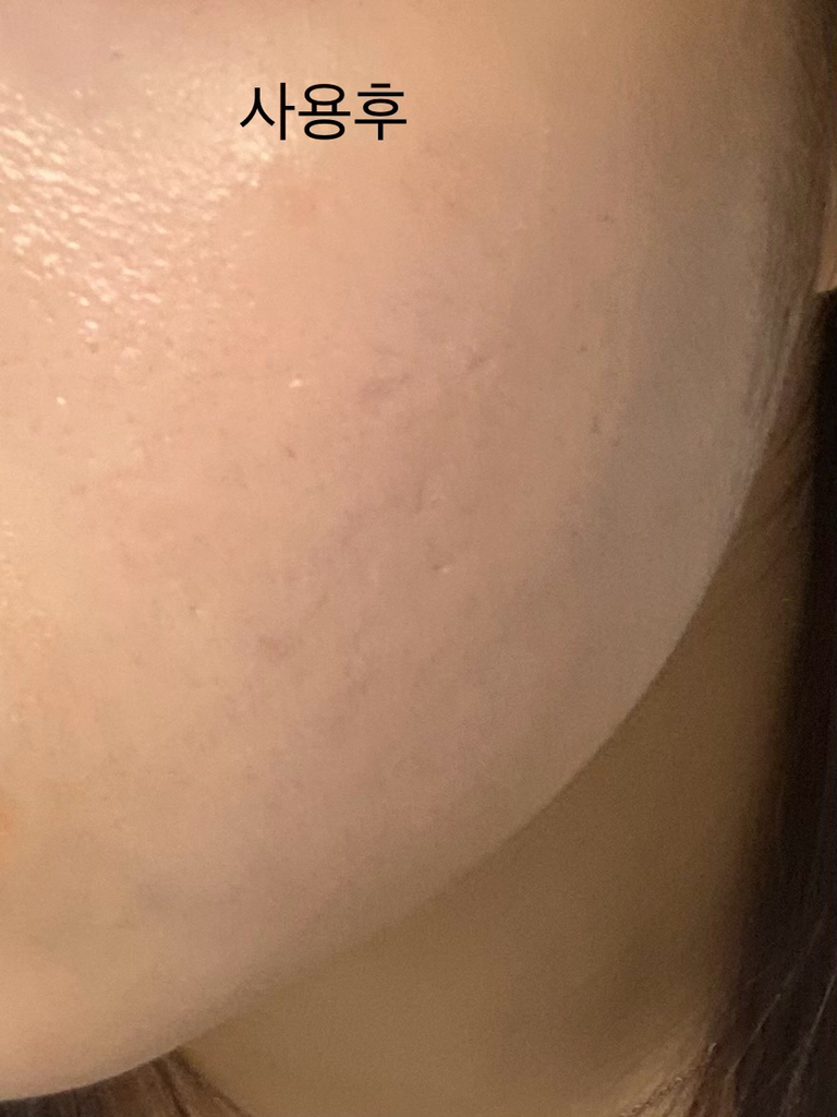 보나메두사 (bonamedusa) 오렌지 스킨 딜리트 [오리지널] review image