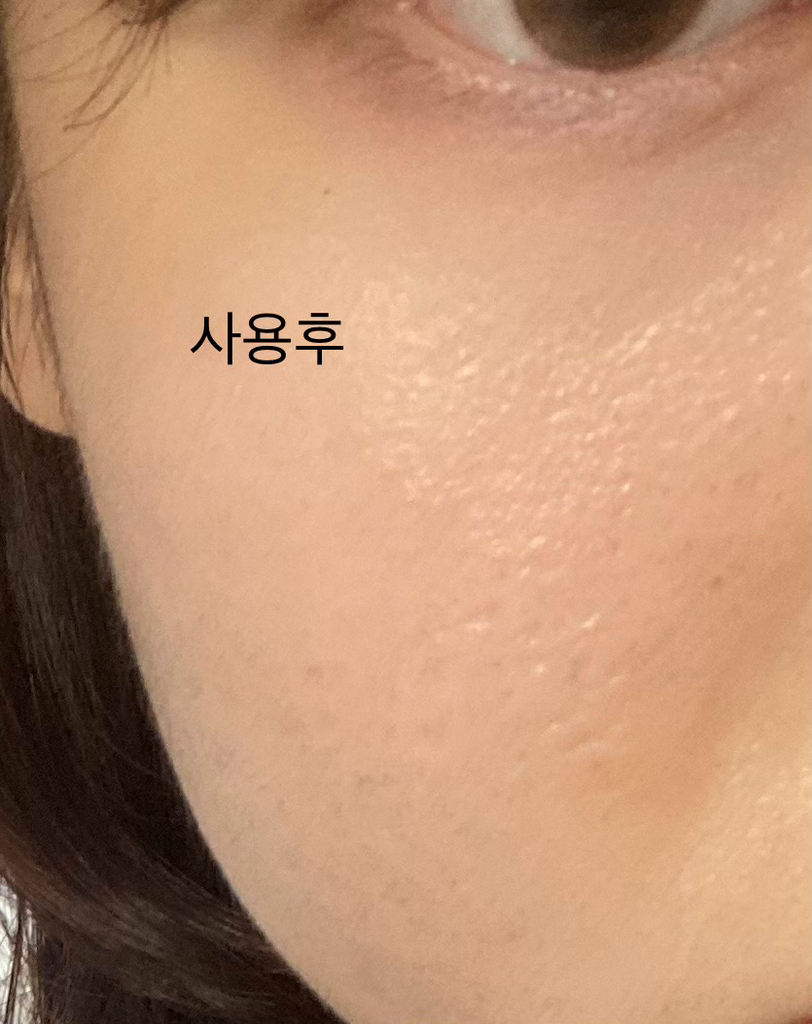 보나메두사 (bonamedusa) 오렌지 스킨 딜리트 [오리지널] review image