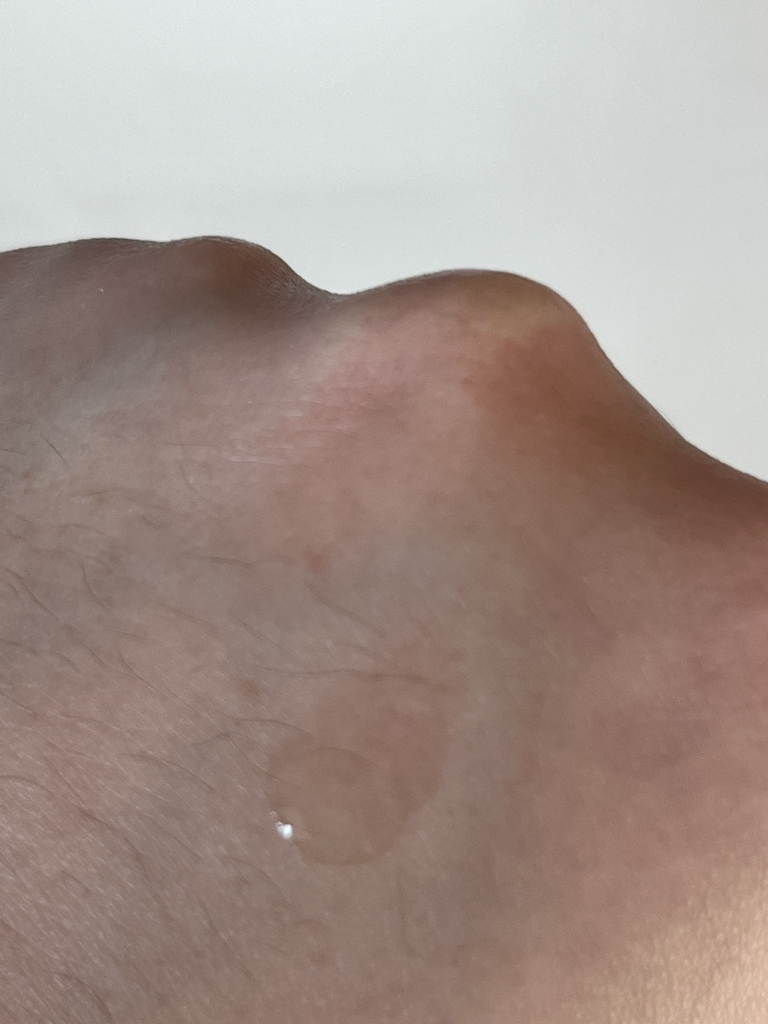 어퓨더퓨어 (A'pieuthepure) 더퓨어 티트리 에센스 review image