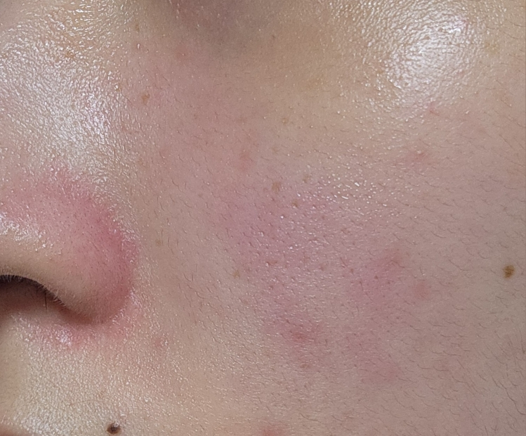 Ảnh đánh giá thực tế của người dùng về Ampoule of cicaterol