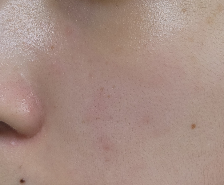 Ảnh đánh giá thực tế của người dùng về Ampoule of cicaterol