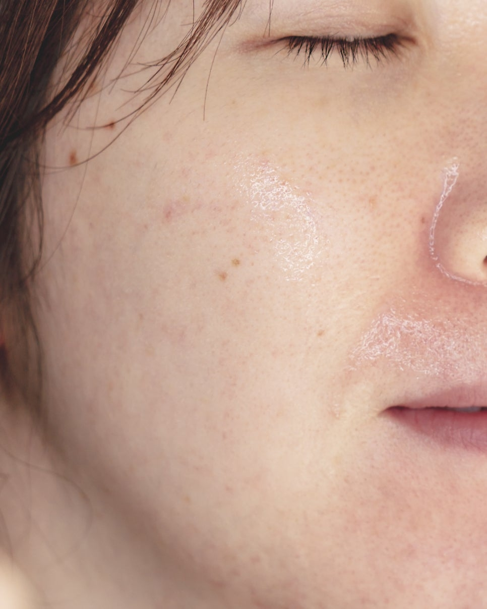 스킨푸드 (SKINFOOD) 블루 캐모마일 히알루로닉 토너 미스트 review image