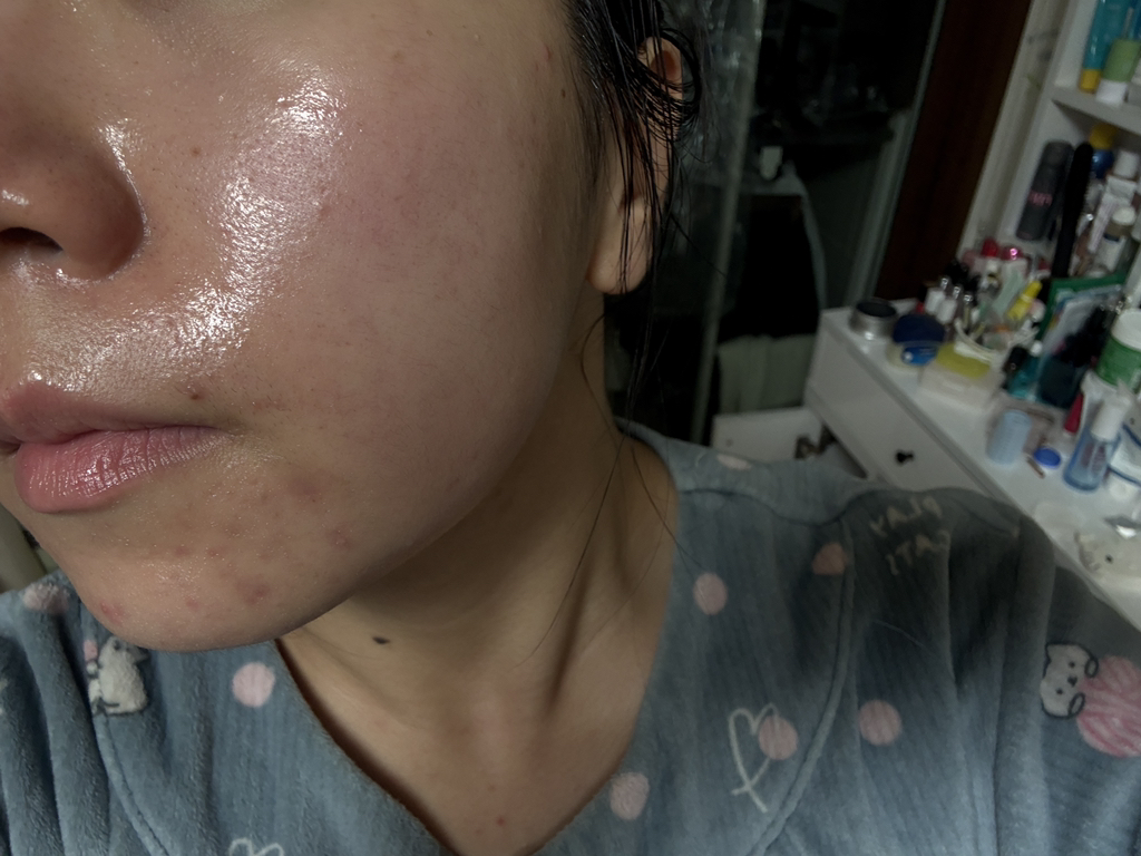 웰라쥬 (WELLAGE) 하이퍼 PDRN 원데이 키트 review image