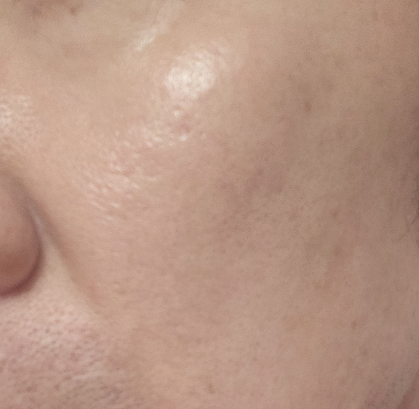 리에종드로렌 (LiaisondeLOREN) 얼티메잇 퍼스트 에센스 review image