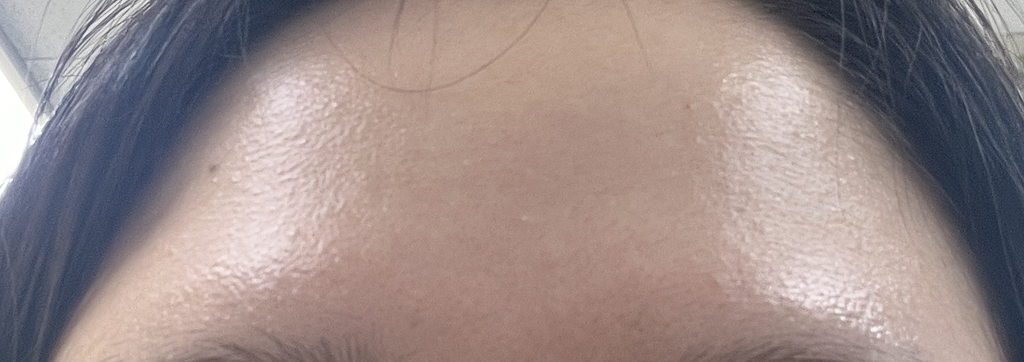 이즈앤트리 (IsNtree) 초저분자 히아루론산 토너 review image