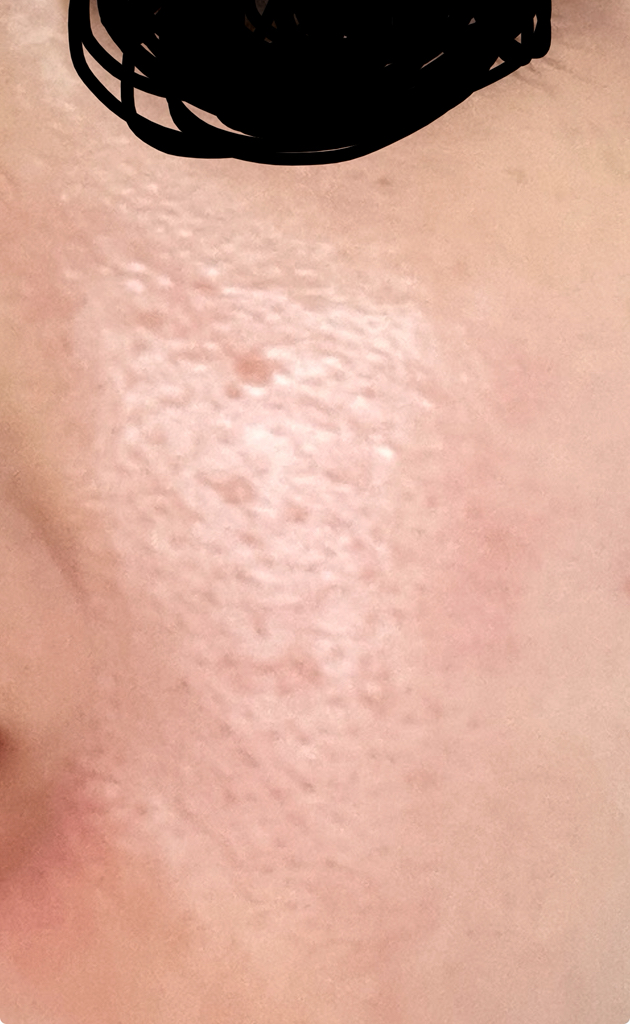 Ảnh đánh giá thực tế của người dùng về Mặt nạ hyaluronic acid phân tử thấp Dive In