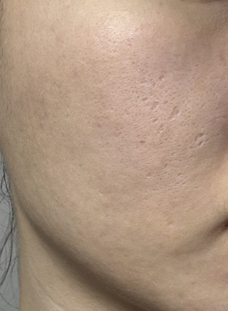 엘라비에코스메틱 (elraviecosmetic) 하이시카뮤 앰플 review image