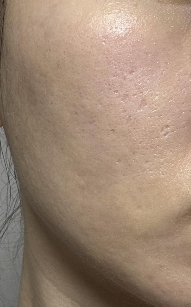 엘라비에코스메틱 (elraviecosmetic) 하이시카뮤 앰플 review image