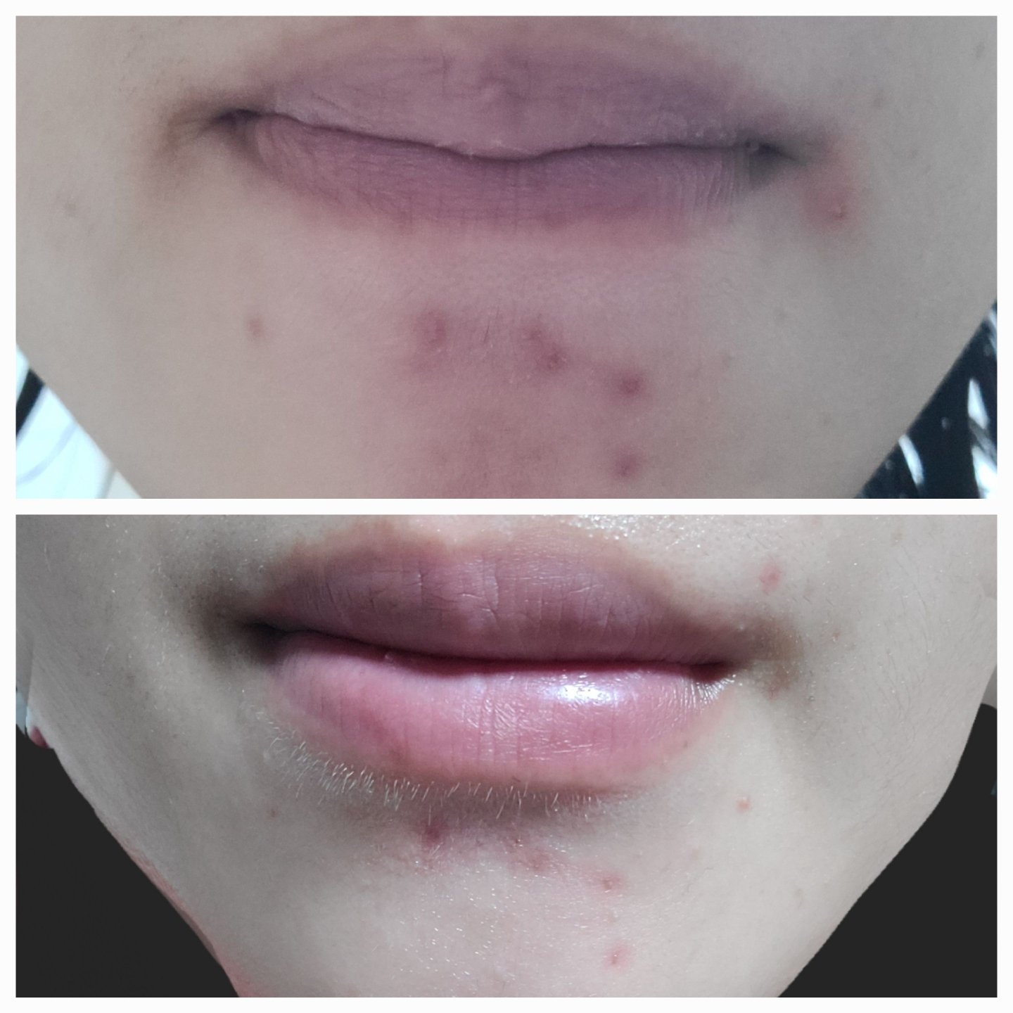 엘라비에코스메틱 (elraviecosmetic) 하이시카뮤 앰플 review image