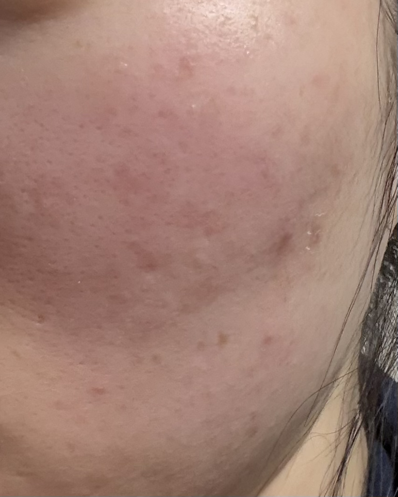 웰라쥬 (WELLAGE) 하이퍼 PDRN 원데이 키트 review image