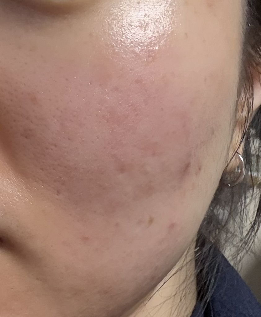 웰라쥬 (WELLAGE) 하이퍼 PDRN 원데이 키트 review image