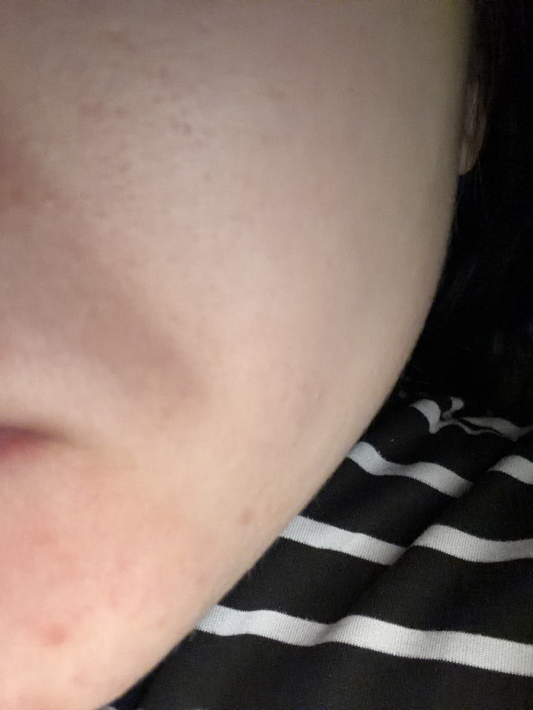 SKIN1004 Madagascar Centella Hyalu-Sica Water Fit Sun Serum [SPF50+/PA++++] review image