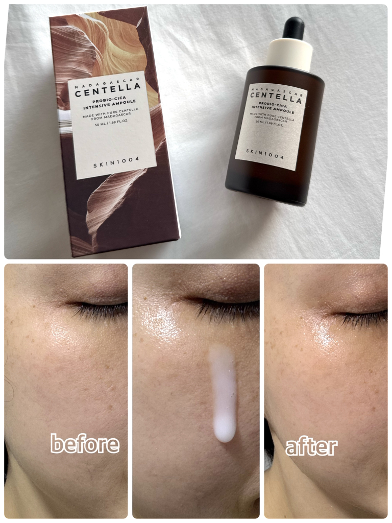 스킨1004 (SKIN1004) 마다가스카르 센텔라 프로바이오시카 인텐시브 앰플 review image