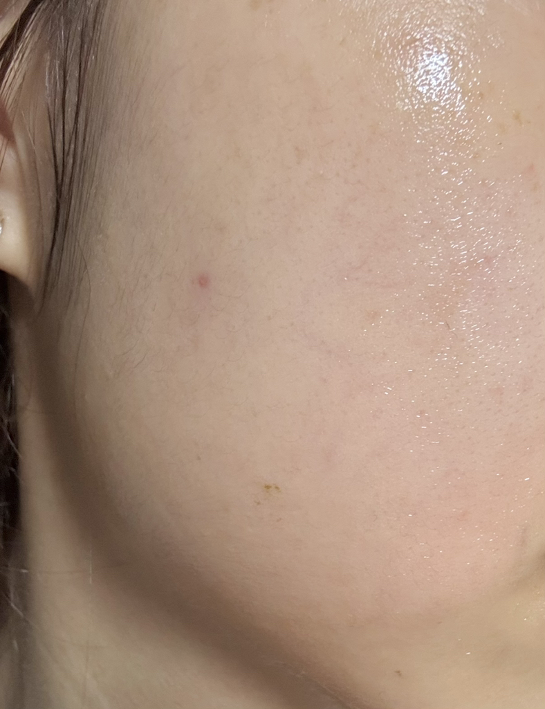 엘라비에코스메틱 (elraviecosmetic) 하이시카뮤 앰플 review image