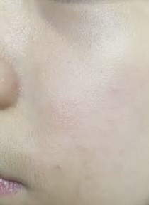 비플레인 (beplain) 시카테롤 블레미쉬 패드 review image