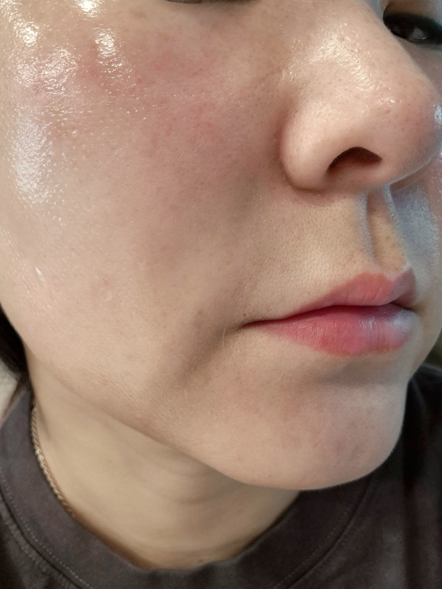 셀누트 (CellNutt) 마이세컨스킨 콜라겐 review image