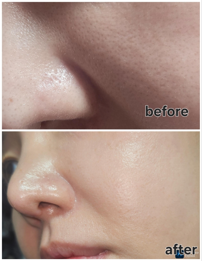 보나메두사 (bonamedusa) 워터 오렌지 스킨 딜리트 review image