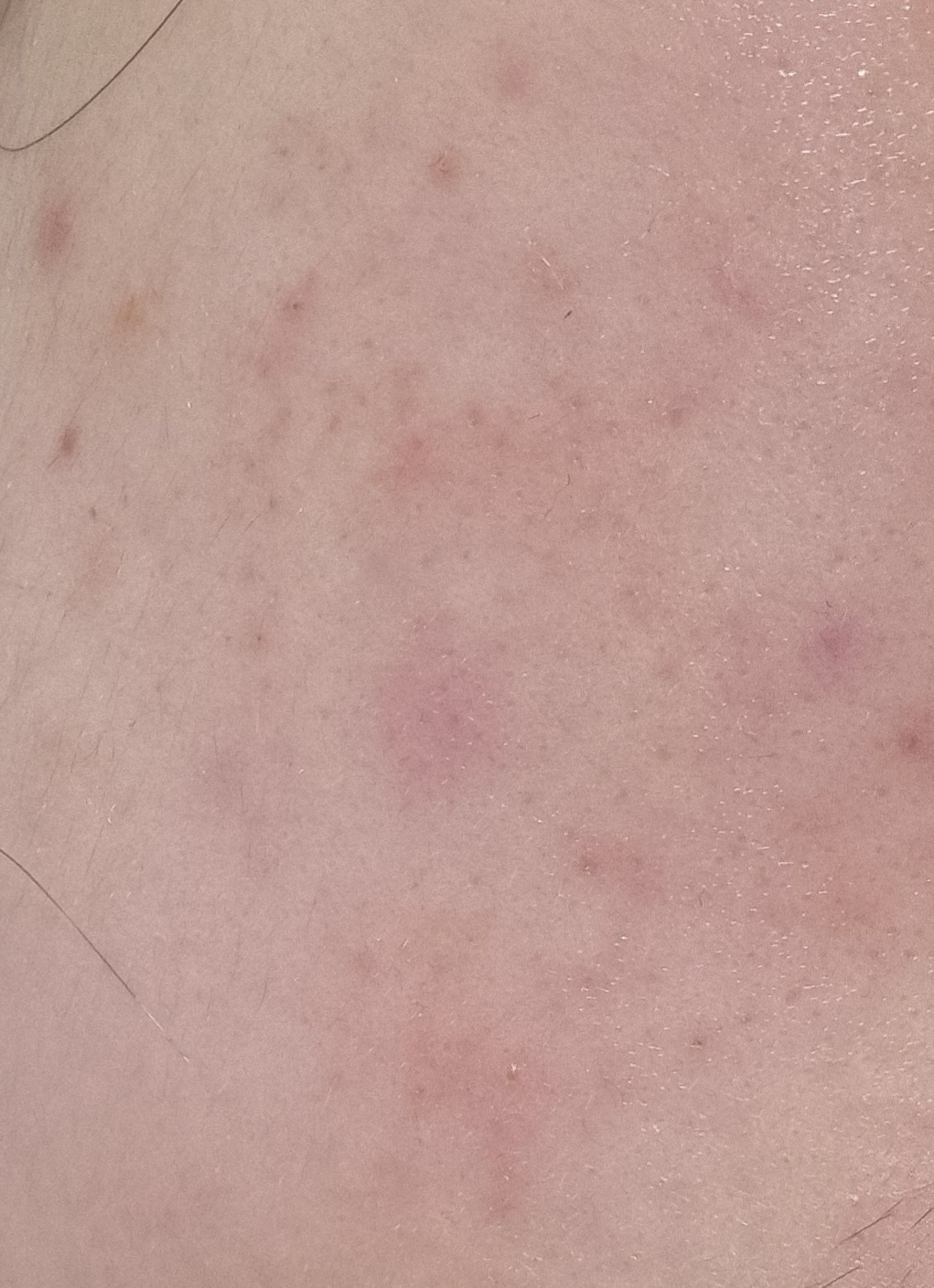 아비브 (Abib) 어성초 테카 캡슐 세럼 카밍 드롭 review image