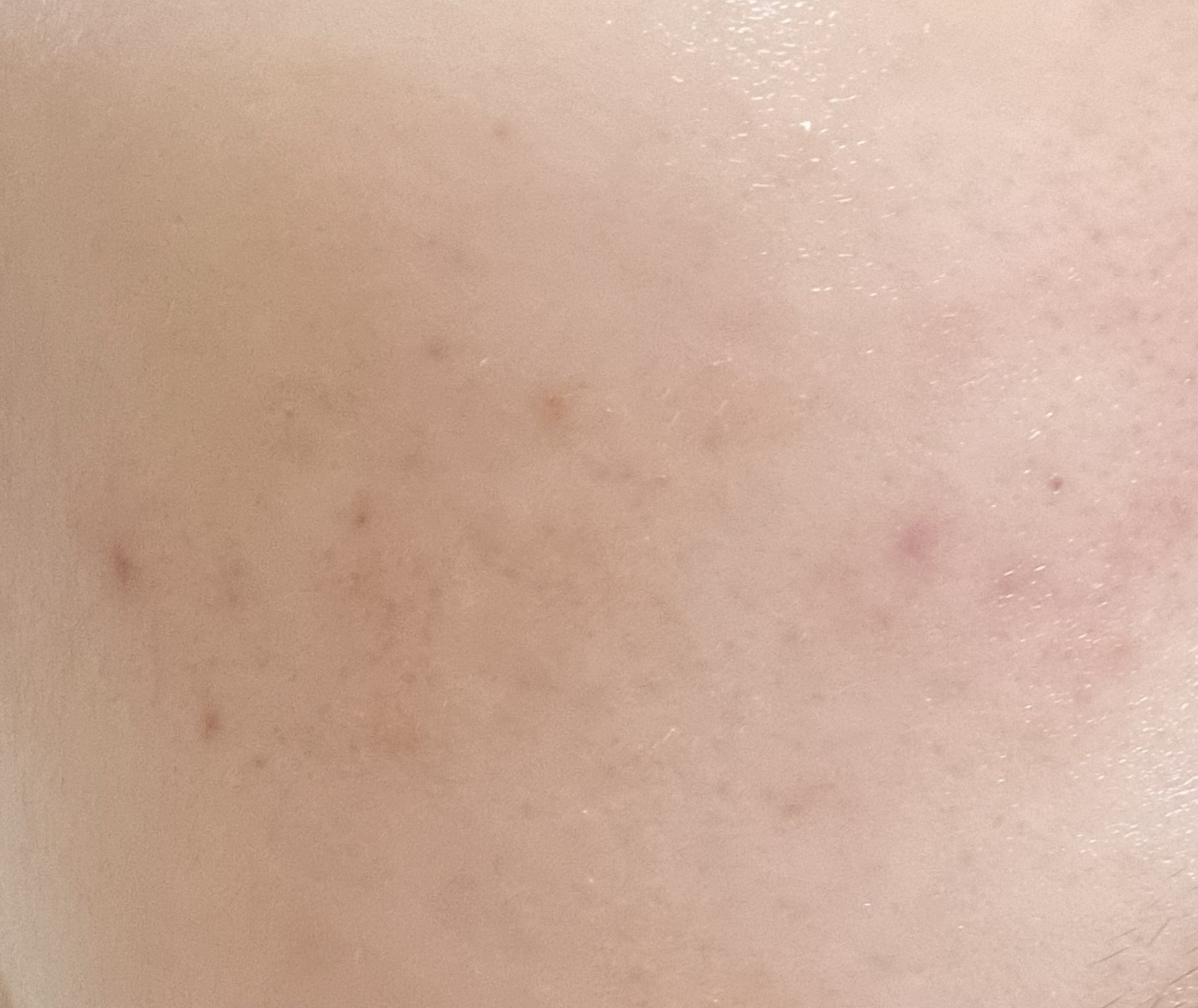 아비브 (Abib) 어성초 테카 캡슐 세럼 카밍 드롭 review image