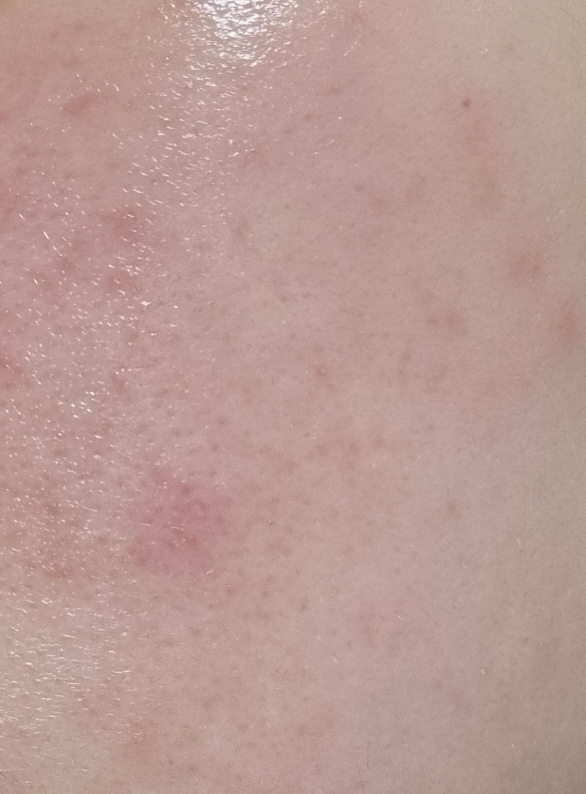 아비브 (Abib) 어성초 테카 캡슐 세럼 카밍 드롭 review image