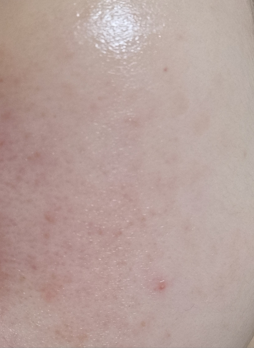 아비브 (Abib) 어성초 테카 캡슐 세럼 카밍 드롭 review image