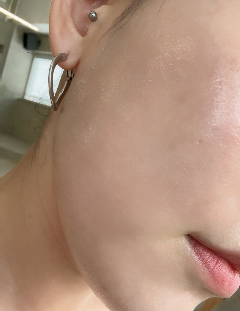 믹순 (mixsoon) 히알레배 포어 버블 세럼 review image