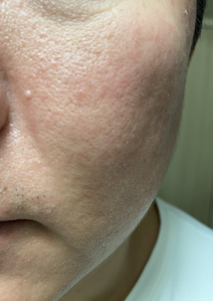 오드로이 (ODELOI) 모공수축 시카 83.7 콜라겐 미스트 앰플 로프디 review image