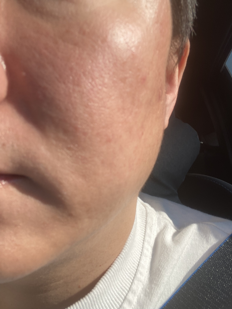 오드로이 (ODELOI) 모공수축 시카 83.7 콜라겐 미스트 앰플 로프디 review image