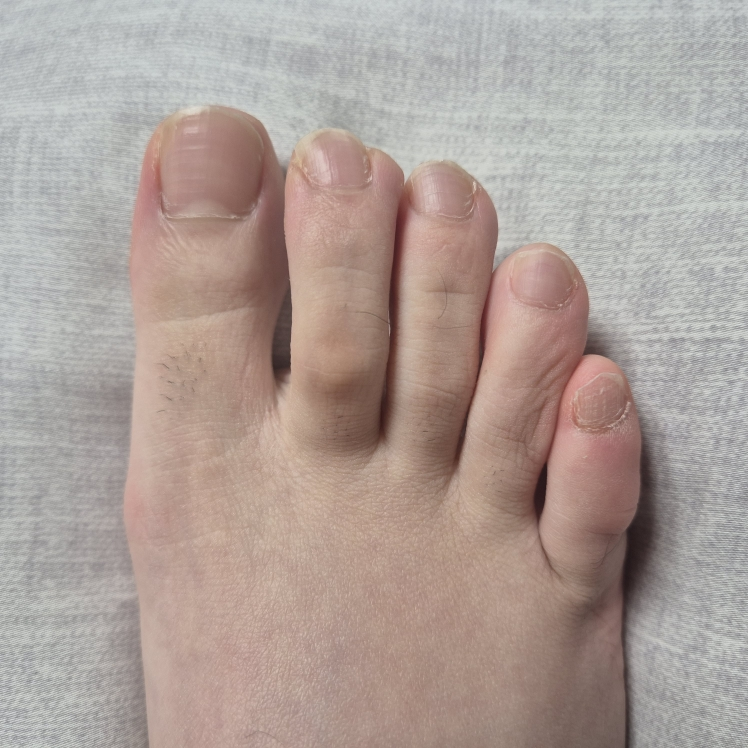 아워덤 (OURDERM) 타임리스뷰티 네일솔루션 review image