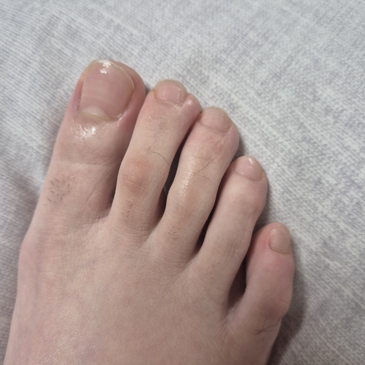 아워덤 (OURDERM) 타임리스뷰티 네일솔루션 review image