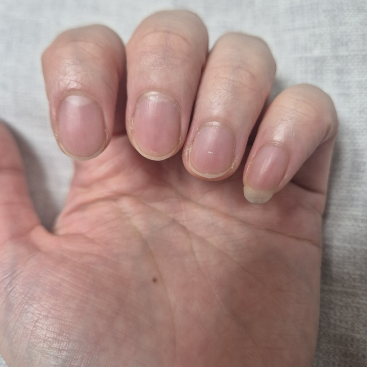 아워덤 (OURDERM) 타임리스뷰티 네일솔루션 review image